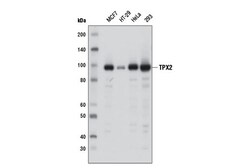 Cell Signaling Technology&nbsp;TPX2 D9Y1V Rabbit mAb 100 ul