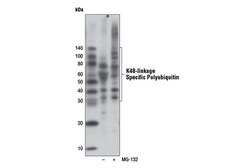 Cell Signaling Technology&nbsp;K48-linkage Specific Polyubiqu