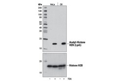 Cell Signaling Technology&nbsp;Acetyl-Histone H2B Lys5 D5H