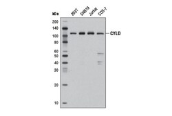 Cell Signaling Technology&nbsp;CYLD D6O5O Rabbit mAb 100 ul