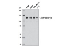 Cell Signaling Technology&nbsp;AFAP1L2/XB130 D4A5 Rabbit mA