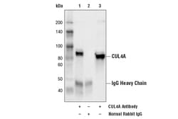 Cell Signaling Technology&nbsp;Ubiquitin E3 Ligase Complex An