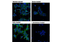Cell Signaling Technology&nbsp;Acetyl-CoA Carboxylase 1 and 2