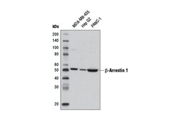 Cell Signaling Technology&nbsp;beta-Arrestin 1 D8O3J Rabbit