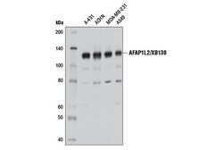 Cell Signaling Technology&nbsp;AFAP1L2/XB130 D1B5 Rabbit mA