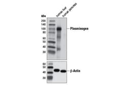 Cell Signaling Technology&nbsp;Plasminogen Antibody 100 ul