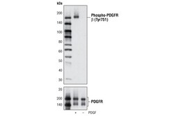 Cell Signaling Technology PDGF Receptor Activation Antib