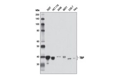 Cell Signaling Technology&nbsp;TBP D5G7Y Rabbit mAb 100 ul