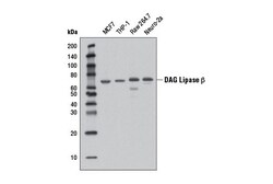 Cell Signaling Technology&nbsp;DAG Lipase beta D4P7C Rabbit