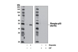 Cell Signaling Technology&nbsp;Phospho-p53 Ser15 D4S1H Ra