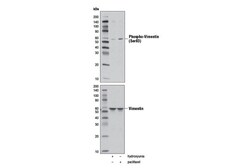 Cell Signaling Technology&nbsp;Phospho-Vimentin Ser83 D5A2