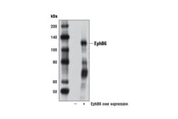 Cell Signaling Technology&nbsp;EphB6 Antibody 100 ul