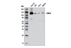 Cell Signaling Technology&nbsp;EML4 D5V6M Rabbit mAb 100 ul