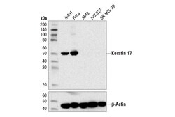 Cell Signaling Technology&nbsp;Keratin 17 D12E5 XPR Rabbi