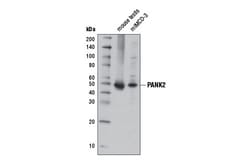 Cell Signaling Technology&nbsp;PANK2 D11E2 Rabbit mAb 100 u