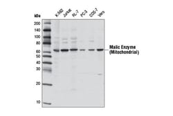 Cell Signaling Technology&nbsp;Malic Enzyme 2 Antibody 100 ul