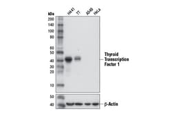 Cell Signaling Technology&nbsp;Thyroid Transcription Factor 1