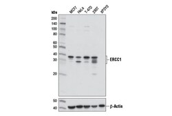 Cell Signaling Technology&nbsp;ERCC1 D6G6 XPR Rabbit mAb