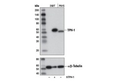 Cell Signaling Technology&nbsp;TPH-1 D10C10 Rabbit mAb 100