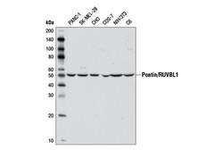 Cell Signaling Technology&nbsp;Pontin/RUVBL1 Antibody 100 ul
