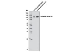 Cell Signaling Technology&nbsp;ATP2A1/SERCA1 D54G12 Rabbit