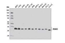 Cell Signaling Technology&nbsp;RCAS1 D2B6N XPR Rabbit mAb
