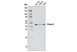 Cell Signaling Technology&nbsp;Protor-2 D19A5 Rabbit mAb 10