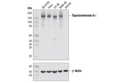 Cell Signaling Technology&nbsp;Topoisomerase II-alpha D10G9