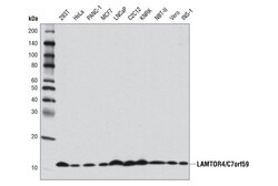 Cell Signaling Technology&nbsp;LAMTOR4/C7orf59 D6A4V Rabbit