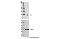 Cell Signaling Technology&nbsp;IL-4 D19A10 Rabbit mAb 100 u