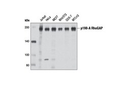 Cell Signaling Technology&nbsp;p190-A RhoGAP D8Q6C Rabbit m