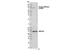 Cell Signaling Technology&nbsp;Phospho-ALK Tyr1078 D28B4