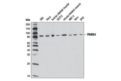 Cell Signaling Technology&nbsp;PANK4 D8N2C Rabbit mAb 100 u