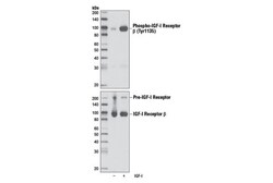 Cell Signaling Technology PhosphoPlusR IGF-I Receptor