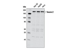 Cell Signaling Technology&nbsp;Tensin 2 Antibody 100 ul