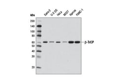 Cell Signaling Technology&nbsp;beta-TrCP D12C8 Rabbit mAb 1