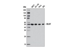 Cell Signaling Technology&nbsp;DLST D22B1XPRRabbit mAb