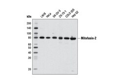 Cell Signaling Technology&nbsp;Mitofusin-2 D1E9 Rabbit mAb