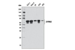 Cell Signaling Technology&nbsp;DYRK2 D9A3K Rabbit mAb 100 u