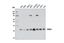 Cell Signaling Technology&nbsp;PINCH 5G7 Mouse mAb 100 ul