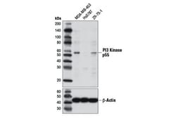 Cell Signaling Technology&nbsp;PI3 Kinase p55 D2B3 Rabbit m