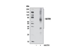 Cell Signaling Technology&nbsp;SSTR1 Antibody 100 ul