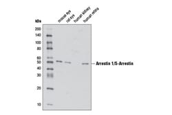 Cell Signaling Technology&nbsp;Arrestin 1/S-Arrestin Antibody