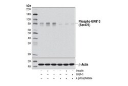 Cell Signaling Technology&nbsp;Phospho-GRB10 Ser476 D4E6