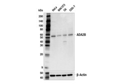 Cell Signaling Technology&nbsp;ADA2B F6G5T Rabbit mAb 100 u