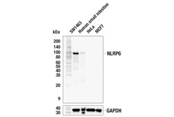 Cell Signaling Technology&nbsp;NLRP6 E2S8A Rabbit mAb 100 u