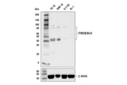 Cell Signaling Technology&nbsp;ITM2B/Bri2 E6O3Y Rabbit mAb