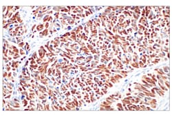 Cell Signaling Technology&nbsp;ASCL1 E5S4Q XPR Rabbit mAb