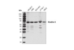 Cell Signaling Technology&nbsp;Kindlin-3 D8I7V Rabbit mAb 1