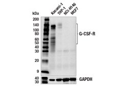 Cell Signaling Technology&nbsp;G-CSF-R E8E7D Rabbit mAb 100